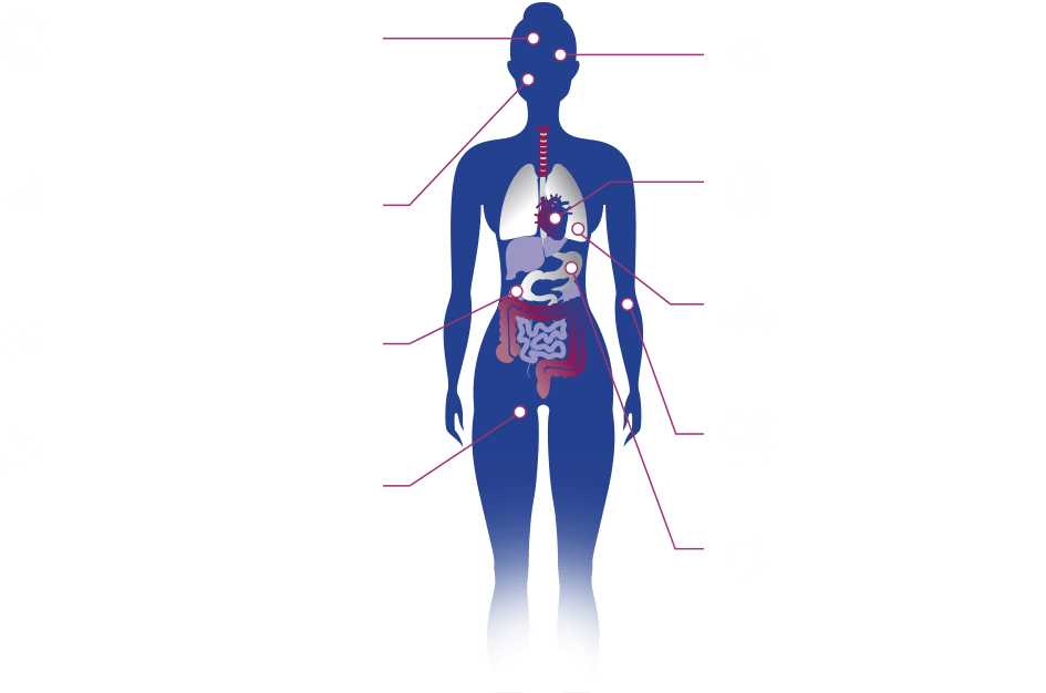 analyse-des-atteintes-spécifiques