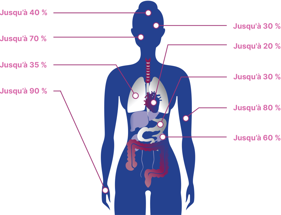 le-les-une-maladie-systemique